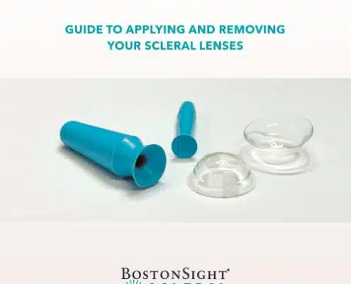 Scleral Lens Application and Removal Guide
