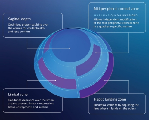 BostonSight Announces New Features for BostonSight SCLERAL