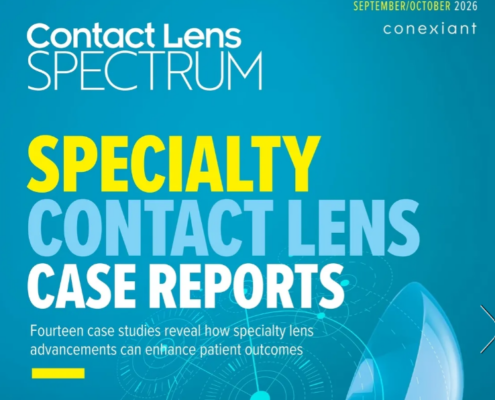 Visual Rehabilitation With a Scleral Lens in an Eye With Corneal Scarring